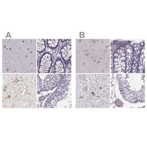 Merck Anti-CALCR antibody produced in rabbit