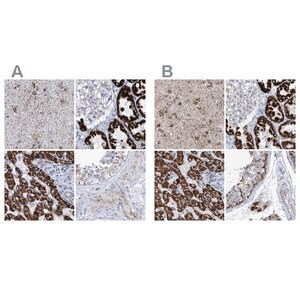 Merck Anti-ALDH6A1 antibody produced in rabbit