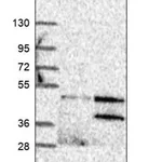 Merck Anti-GNB1L antibody produced in rabbit