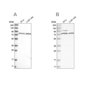 Merck Anti-P2RX7 antibody produced in rabbit