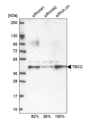 Merck Anti-TBCC antibody produced in rabbit