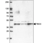 Merck Anti-TBCC antibody produced in rabbit