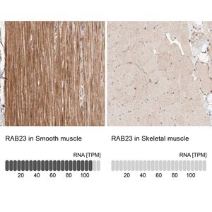 Merck Anti-RAB23 antibody produced in rabbit