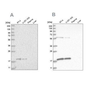 Merck Anti-MRPS10 antibody produced in rabbit