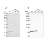 Merck Anti-MRPS10 antibody produced in rabbit