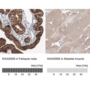Merck Anti-KIAA0556 antibody produced in rabbit