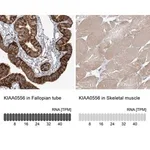 Merck Anti-KIAA0556 antibody produced in rabbit