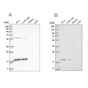 Merck Anti-MRPS10 antibody produced in rabbit
