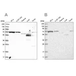 Merck Anti-SLC25A12 antibody produced in rabbit