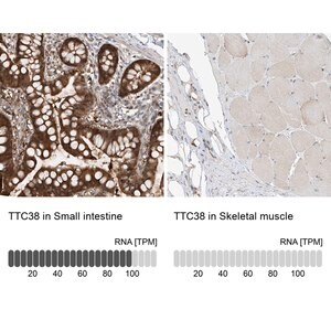 Merck Anti-TTC38 antibody produced in rabbit
