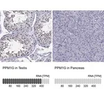 Merck Anti-PPM1G antibody produced in rabbit
