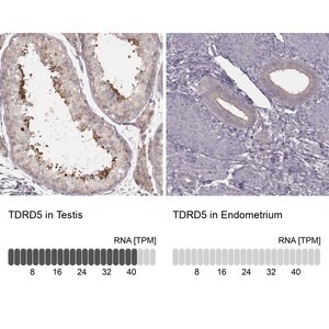 Merck Anti-TDRD5 antibody produced in rabbit