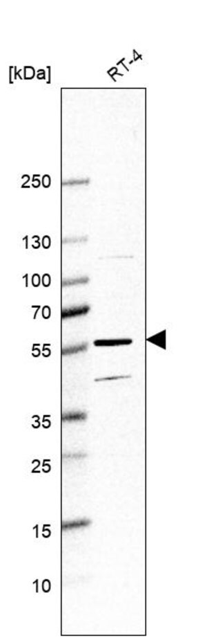 Merck Anti-HYAL4 antibody produced in rabbit