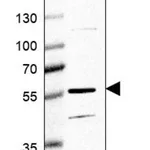 Merck Anti-HYAL4 antibody produced in rabbit