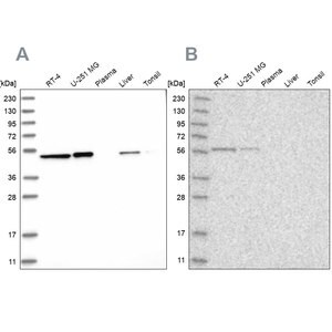 Merck Anti-QRSL1 antibody produced in rabbit