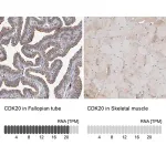 Merck Anti-CDK20 antibody produced in rabbit