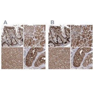 Merck Anti-PSMB1 antibody produced in rabbit