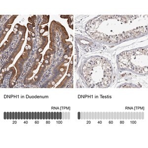 Merck Anti-DNPH1 antibody produced in rabbit