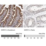 Merck Anti-DNPH1 antibody produced in rabbit