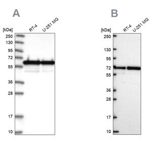 Merck Anti-CCDC47 antibody produced in rabbit