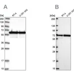 Merck Anti-CCDC47 antibody produced in rabbit