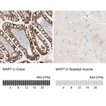 Merck Anti-MAP7 antibody produced in rabbit