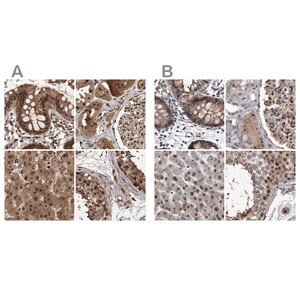 Merck Anti-RAD23B antibody produced in rabbit