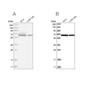 Merck Anti-PGM3 antibody produced in rabbit