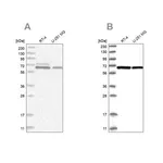 Merck Anti-PGM3 antibody produced in rabbit