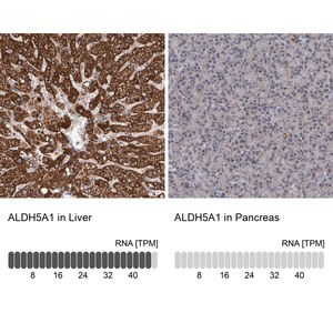 Merck Anti-ALDH5A1 antibody produced in rabbit