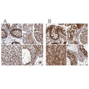 Merck Anti-RAD23B antibody produced in rabbit