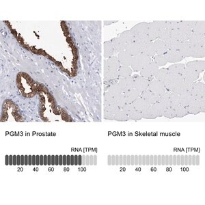 Merck Anti-PGM3 antibody produced in rabbit