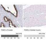 Merck Anti-PGM3 antibody produced in rabbit