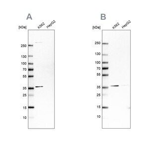 Merck Anti-OTUD6B antibody produced in rabbit