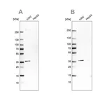 Merck Anti-OTUD6B antibody produced in rabbit