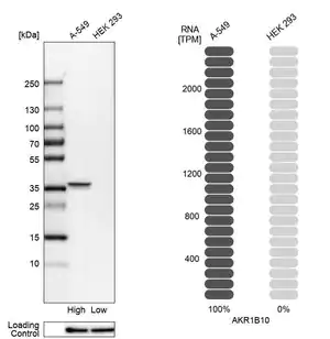 Merck Anti-AKR1B10 antibody produced in rabbit