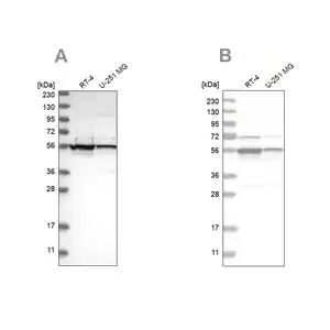 Merck Anti-DDX6 antibody produced in rabbit