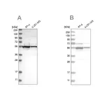 Merck Anti-DDX6 antibody produced in rabbit
