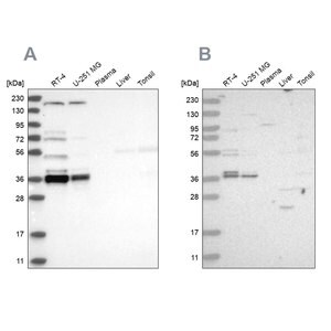 Merck Anti-C1orf131 antibody produced in rabbit