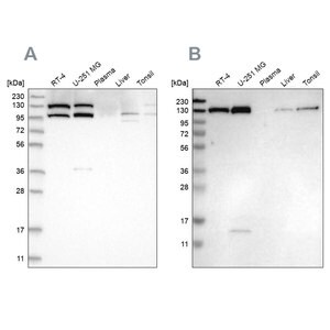 Merck Anti-XPO5 antibody produced in rabbit