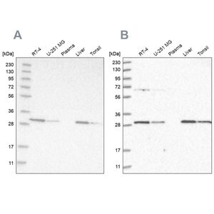 Merck Anti-PROSC antibody produced in rabbit