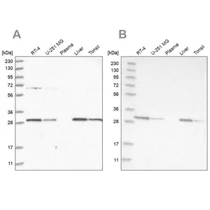 Merck Anti-PROSC antibody produced in rabbit