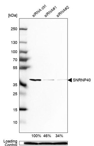 Merck Anti-SNRNP40 antibody produced in rabbit