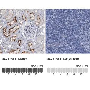 Merck Anti-SLC34A3 antibody produced in rabbit