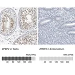 Merck Anti-ZPBP2 antibody produced in rabbit