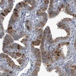 Merck Anti-LRRC6 antibody produced in rabbit