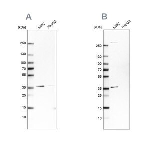 Merck Anti-OTUD6B antibody produced in rabbit