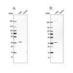 Merck Anti-OTUD6B antibody produced in rabbit
