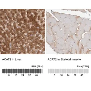 Merck Anti-ACAT2 antibody produced in rabbit