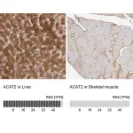 Merck Anti-ACAT2 antibody produced in rabbit